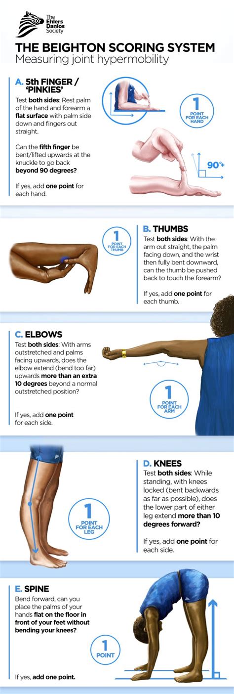 baton harding test|Assessing Joint Hypermobility .